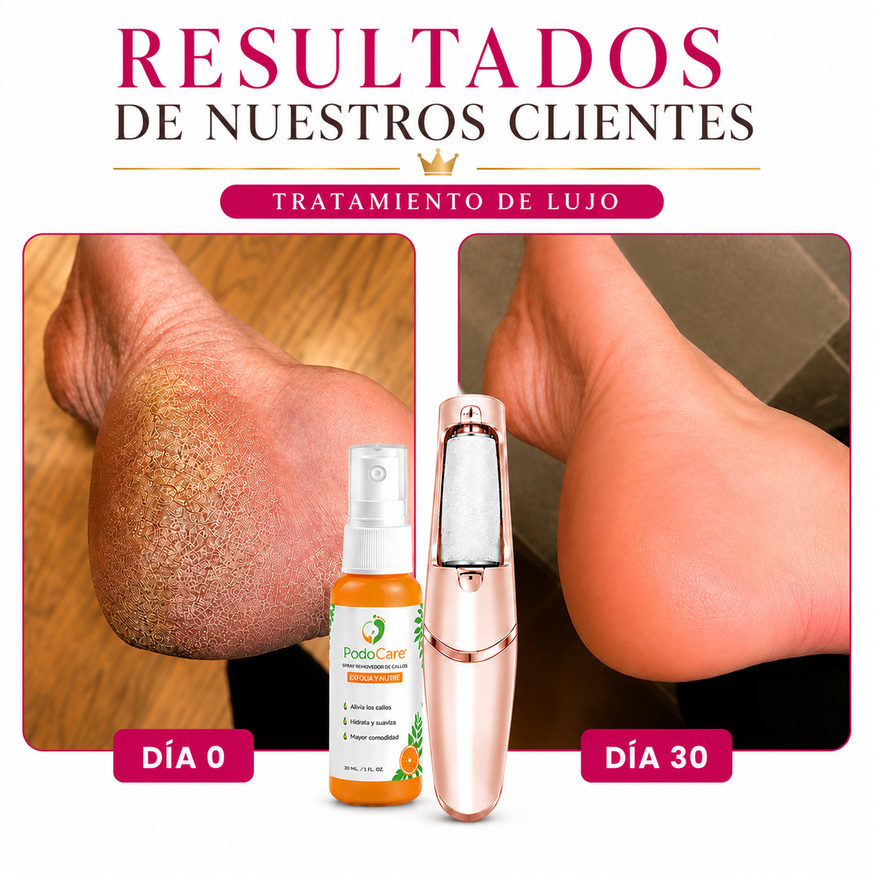 PodoCare Pro - EL CUIDADO DE LUJO PARA TUS PIES